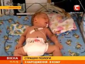 В Ужгороді новонароджений хлопчик з порізами на голові впав у кому - СТБ