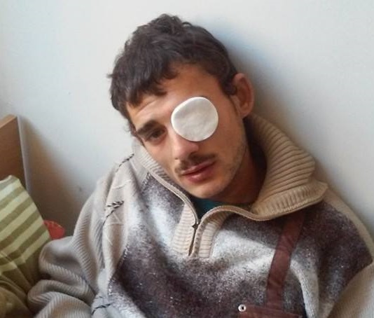В Ужгороді чоловік з розваги вистрілив в око молодому циганові, що порпався в сміттєвому контейнері (ФОТО)