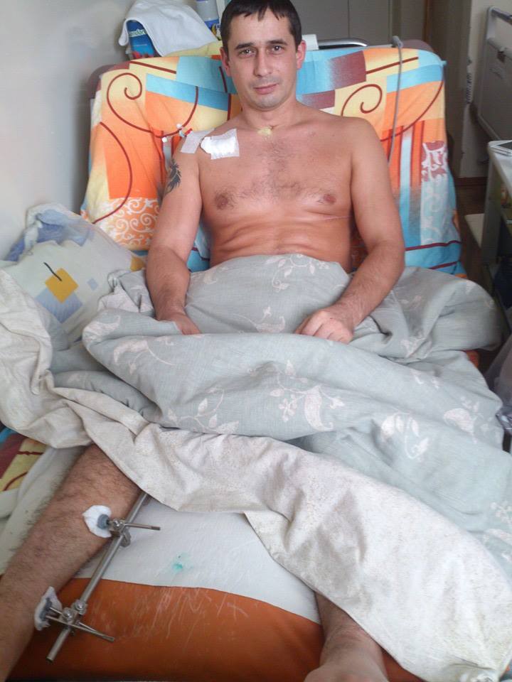 Уродженець Мукачева Рустам Росул, врятувавши побратимів під обстрілом, нині з перебитим хребтом потребує допомоги (ФОТО)