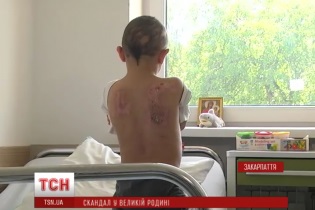 В Ужгороді прийомна мати відлупцювала 9-річного хлопчика до реанімації (ВІДЕО)
