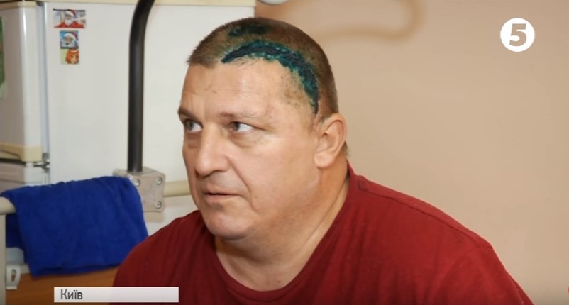 Боєць з Ужгорода, котрий вижив після важкого поранення на Донбасі, частково втратив пам'ять і потребує допомоги (ВІДЕО)