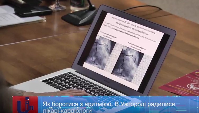 Лікарі-кардіологи з усієї України радилися в Ужгороді, як боротися з аритмією (ВІДЕО)