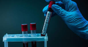 За добу в Ужгороді виявлено 92 нові випадки коронавірусної інфекції