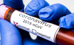 На Виноградівщині за минулу добу підтверджено ще 1 випадок захворювання на коронавірус