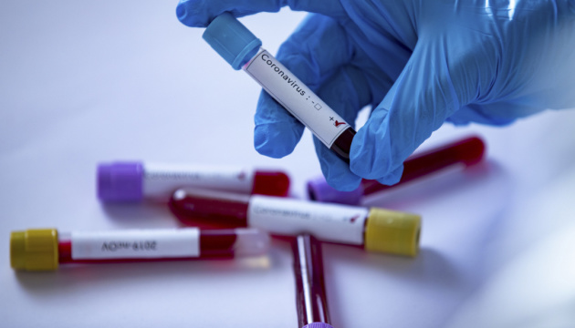 В Ужгороді за добу виявлено 12 випадків коронавірусу