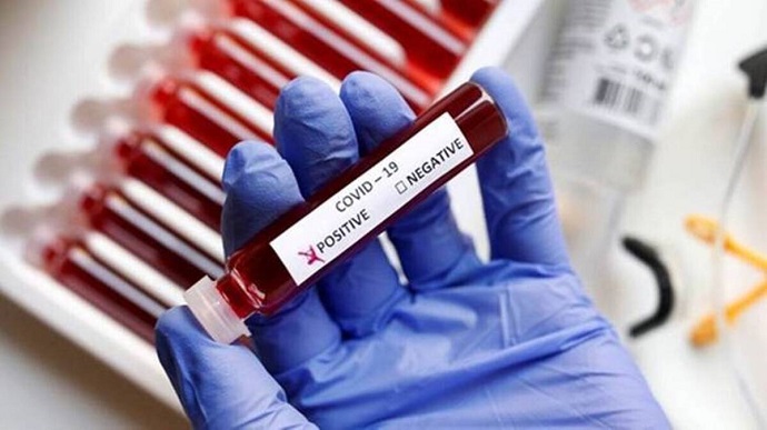 В Ужгороді за минулу добу  виявлено 2 нові випадки коронавірусної інфекції