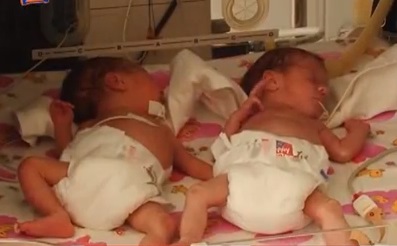 З початку року в Ужгородському "роддомі" 58 жінок народили двійнят і дві – трійню (ВІДЕО)