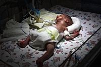 На Берегівщині померло п'ятимісячне немовля
