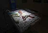 Закарпатка принесла в лікарню своє мертве немовля