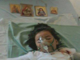 Лікарям не вдалося порятувати 5-річну дівчинку, що впала в каструлю з окропом на Закарпатті