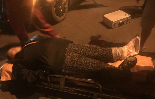 В Ужгороді Audi збив жінку, що вибігла з двору на дорогу (ФОТО)