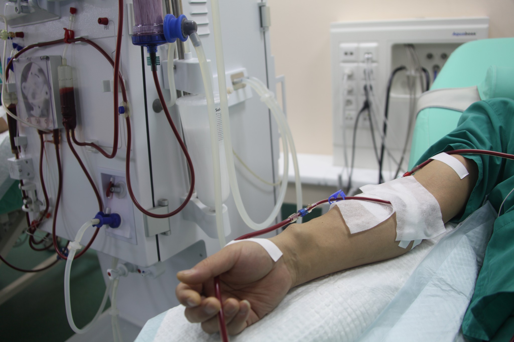 У Мукачеві збільшать фінансування медичної програми для підтримки хворих на ниркову недостатність