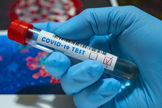 За добу в Ужгороді виявлено 27 нових випадків коронавірусної інфекції, 1 людина померла