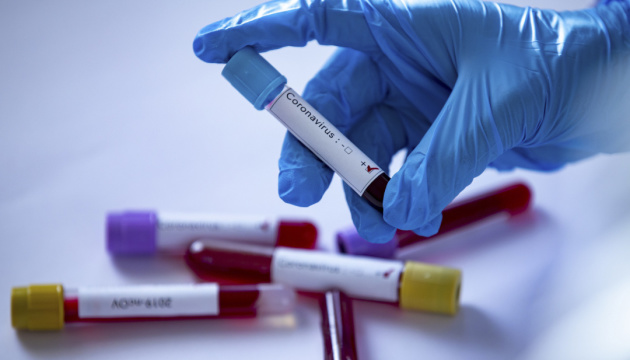 В Ужгороді за добу виявлено 27 нових випадків коронавірусної інфекції, 1 людина померла