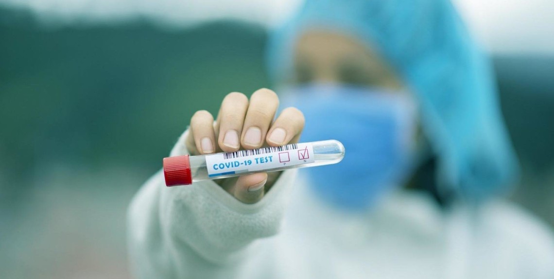 За добу в Ужгороді виявлено 79 нових випадків коронавірусної інфекції