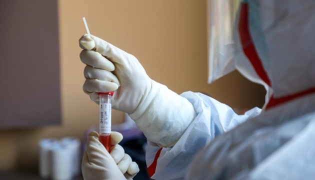 За добу в Ужгороді виявлено 75 нових випадків коронавірусної інфекції, 2 людей померло