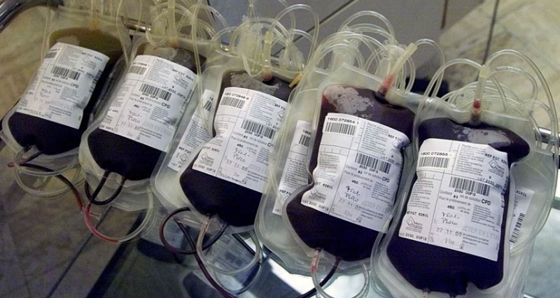 На Закарпатті сформовано понад норму 200 літрів плазми крові