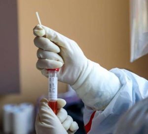 На Тячівщині підтверджено 1 новий випадок захворювання на коронавірус