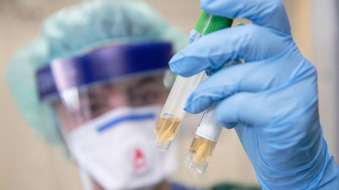 На Виноградівщині нових "коронавірусних" не зафіксовано, видужало 4 пацієнтів