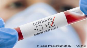 10 нових випадків коронавірусної інфекції виявлено за минулу добу в Ужгороді