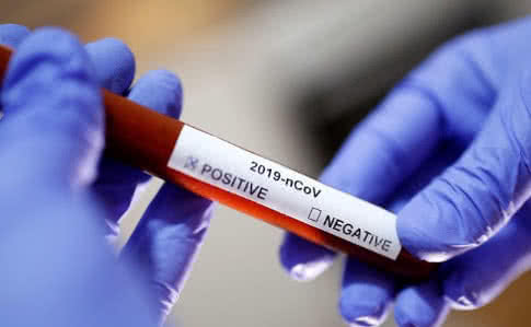 В Ужгороді на ранок 10 травня виявлено 6 нових випадків коронавірусної інфекції