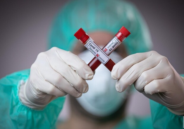 В Ужгороді за добу – 13 нових випадків коронавірусної інфекції та 1 смерть від COVID-19
