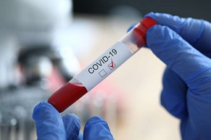 4 нові випадки коронавірусної інфекції виявлено за минулу добу в Ужгороді