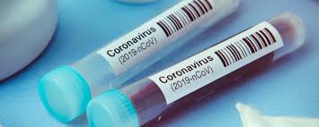 За добу в Ужгороді виявлено 8 нових випадків коронавірусної інфекції