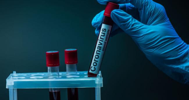 За добу в Ужгороді виявлено 19 нових випадків коронавірусної інфекції