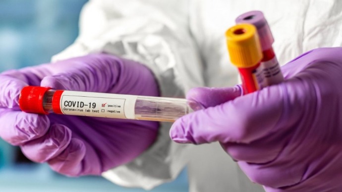 За добу в Ужгороді виявлено 23 нові випадки коронавірусної інфекції