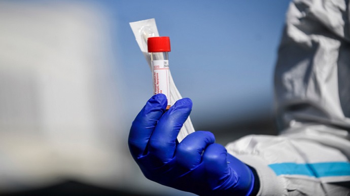 За минулу добу в Ужгороді виявлено 96 нових випадків коронавірусної інфекції, 4 людини померли