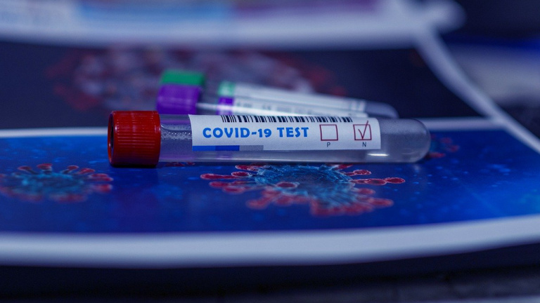 В Ужгороді станом на 20 квітня виявлено 14 нових випадків коронавірусної інфекції, 2 містян померли