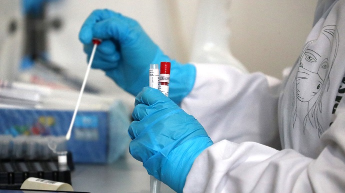 В Ужгороді за добу виявлено 15  нових випадків коронавірусної інфекції, 2 людини померли