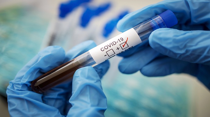 За минулу добу в Ужгороді виявлено 4  нові випадки коронавірусної інфекції, 1 людина померла
