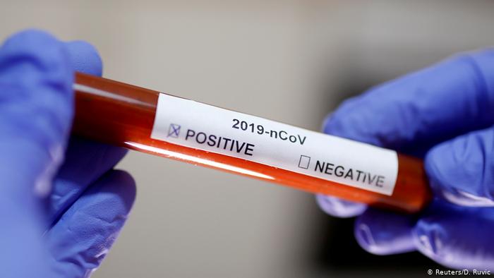 В Ужгороді за добу виявлено 1 новий випадок коронавірусу