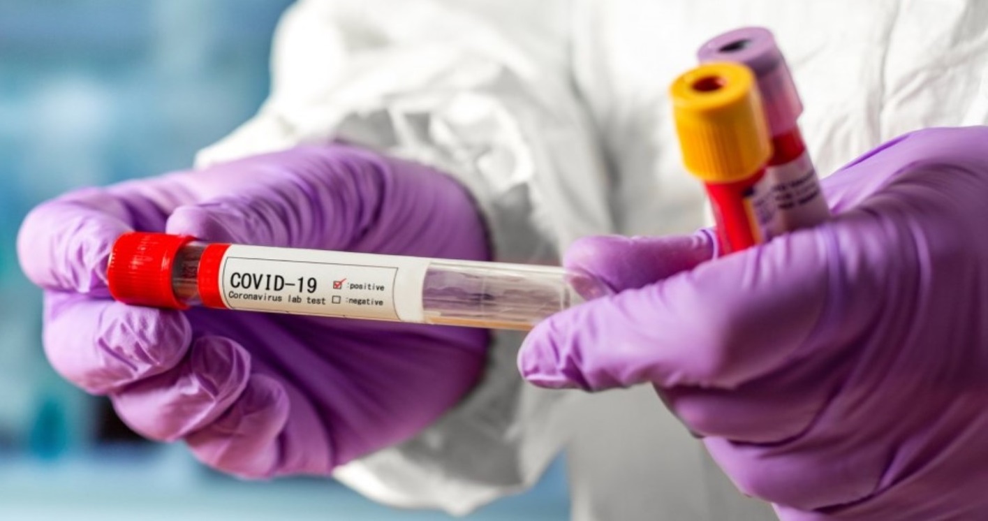 В Ужгороді за минулу добу виявлено 1 новий випадок коронавірусу