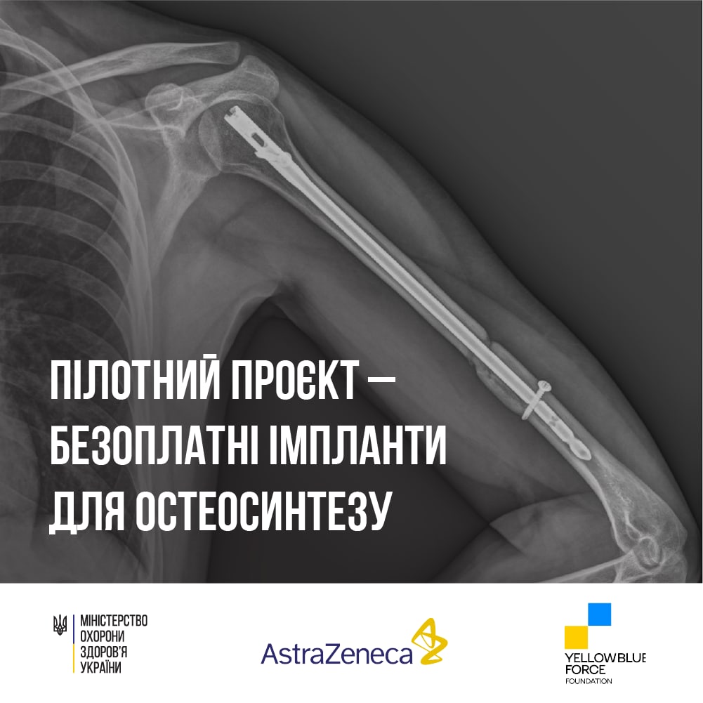 В ужгородській лікарні безоплатно встановлюватимуть імпланти для остеосинтезу людям, постраждалим від війни